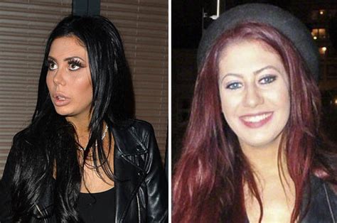 chloe ferry before and after|chloe ferry plastic surgery timeline.